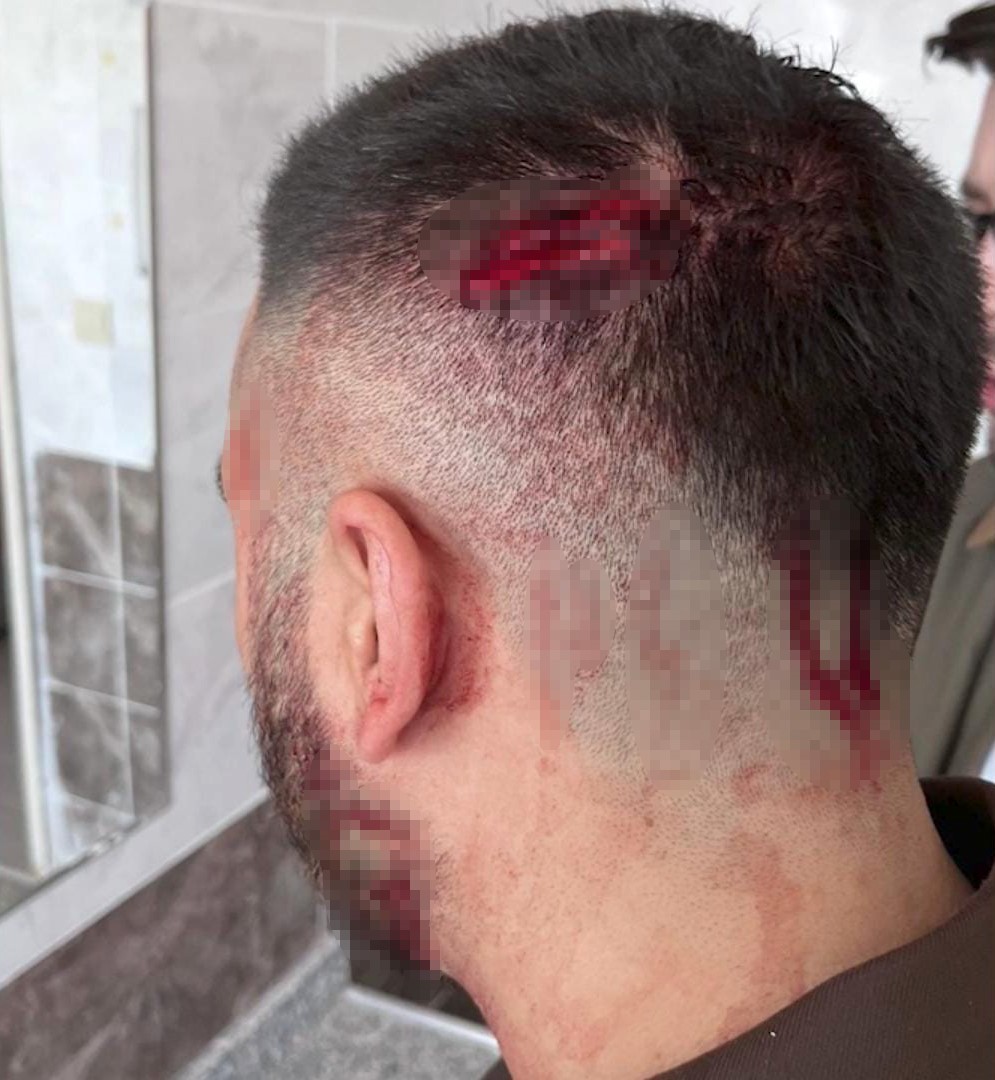 Şanlıurfa’nın Haliliye ilçesinde bir ilkokul öğretmeni, veli tarafından sopayla darbedildi.