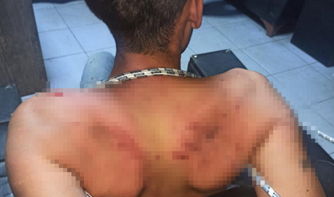 Antalya’da Vedat Kurt’a (22) 3 gün boyunca işkence yaptığı öne