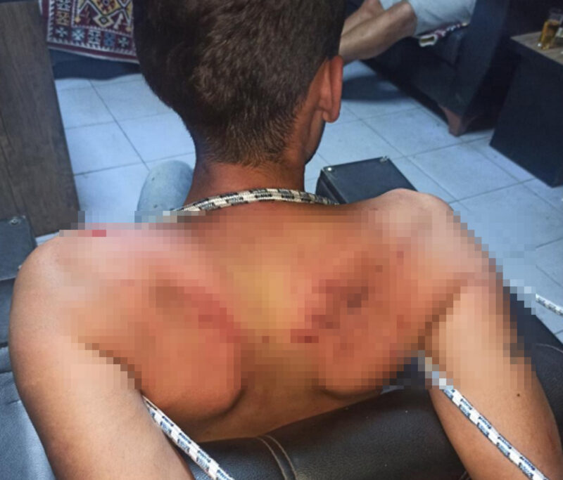 Antalya’da Vedat Kurt’a (22) 3 gün boyunca işkence yaptığı öne