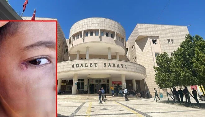 Öğrencinin yüzünde sigara söndürdü Şanlıurfa’nın Harran ilçesinde, 7 yaşındaki ilkokul öğrencisi M.B.’yi dövüp yüzünde