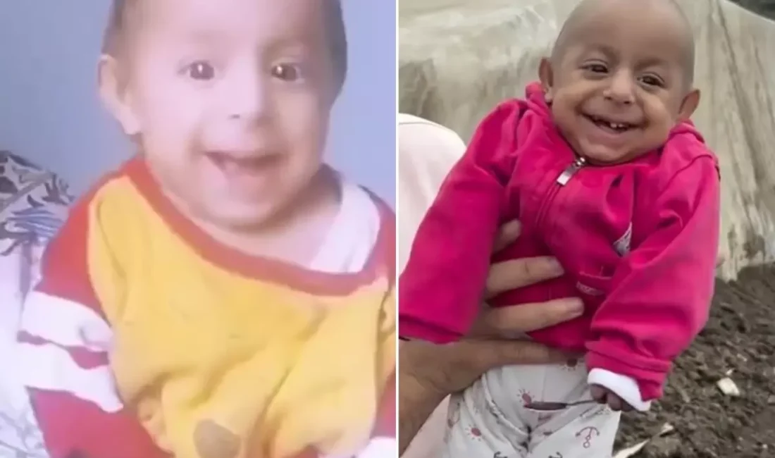 Sosyal medyada "Gülen Bebek" olarak tanınan ve sevimli gülümsemesiyle binlerce