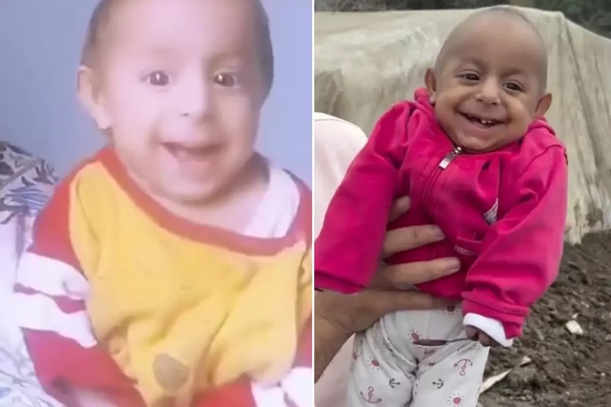 Sosyal medyada "Gülen Bebek" olarak tanınan ve sevimli gülümsemesiyle binlerce