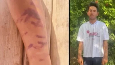 Gaziantep'in Nizip ilçesinde lazer epilasyon için bir güzellik merkezine giden