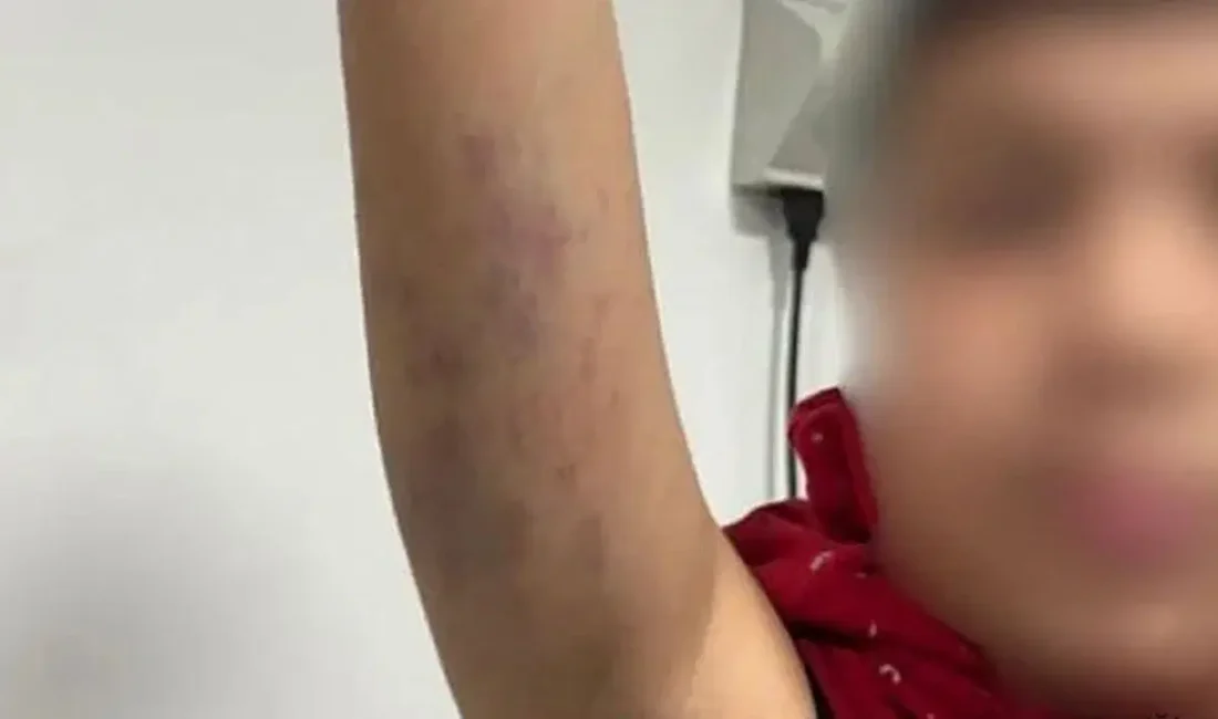 İstanbul’un Bayrampaşa ilçesindeki Ali Ülker Ortaokulu’nda okuyan otizmli bir öğrencinin