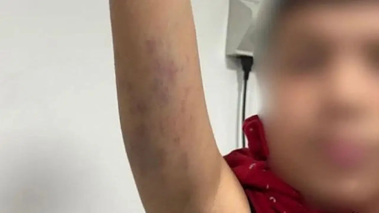 İstanbul’un Bayrampaşa ilçesindeki Ali Ülker Ortaokulu’nda okuyan otizmli bir öğrencinin