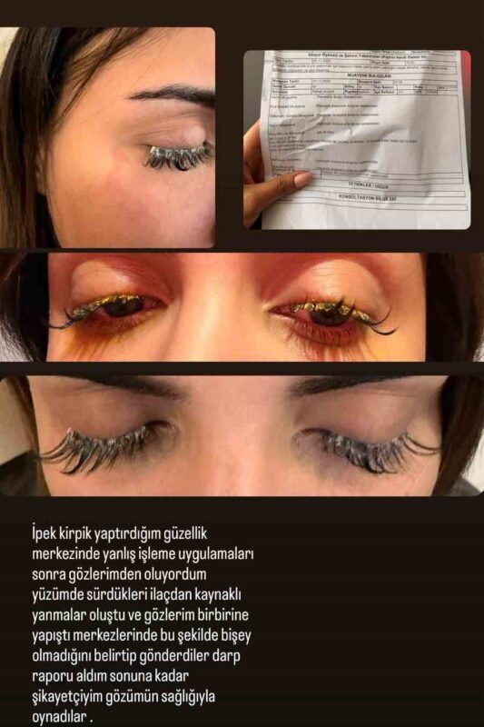 İstanbul’da kirpik yaptırmak isteyen Dilara Çalışkan, güzellik salonunda yapılan hatalı