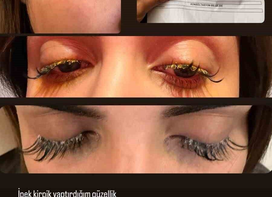 İstanbul’da kirpik yaptırmak isteyen Dilara Çalışkan, güzellik salonunda yapılan hatalı