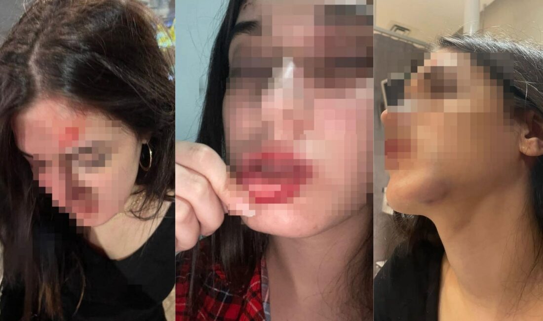 Samsun’un Atakum ilçesinde Belinay Ceren M., eski erkek arkadaşı ve