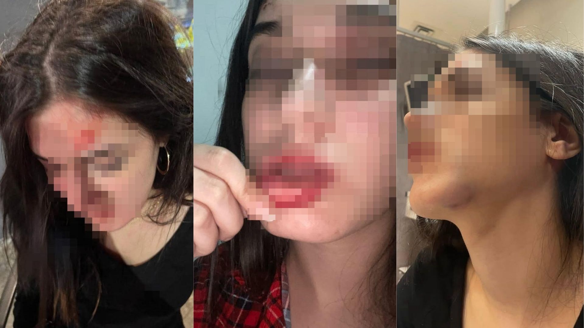 Samsun’un Atakum ilçesinde Belinay Ceren M., eski erkek arkadaşı ve