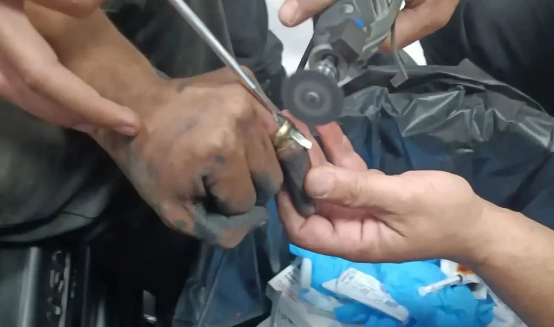 Batman Eğitim ve Araştırma Hastanesine başvuran 52 yaşındaki Aslıhan Orak’ın