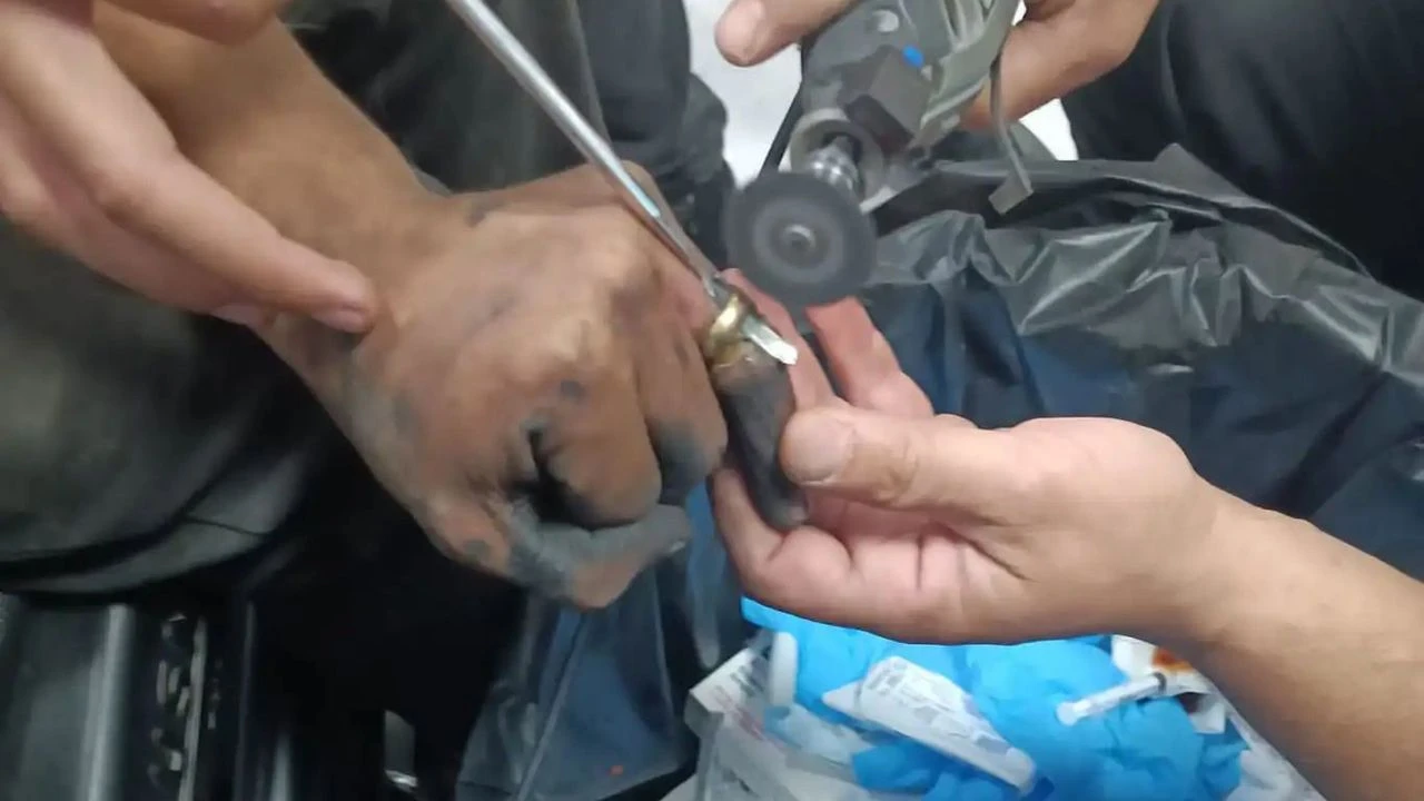 Batman Eğitim ve Araştırma Hastanesine başvuran 52 yaşındaki Aslıhan Orak’ın