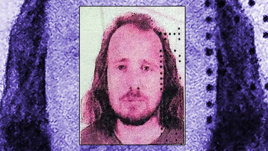 İstanbul Şişli’de saç ekimi ve diş tedavisi gören İngiliz vatandaşı