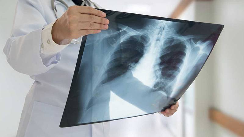 "Öksürük ve balgam devam ediyorsa..."