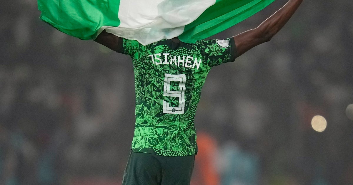 GALATASARAY Kulübü, Victor Osimhen'in sağlık durumu hakkında yaptığı açıklamada, oyuncunun