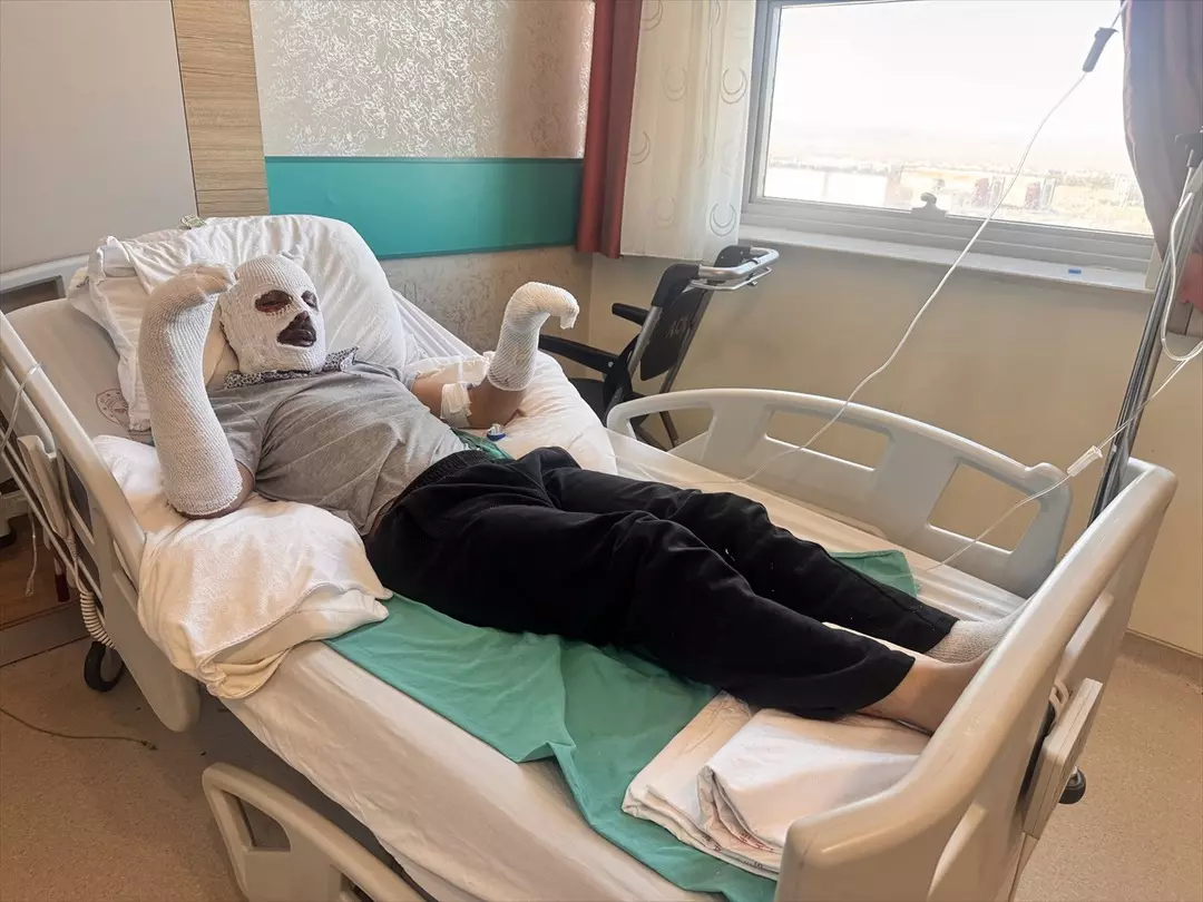 Çay demlemek için mutfağa gitti, olacaklardan bir haberdi. Mutfak tüpünün