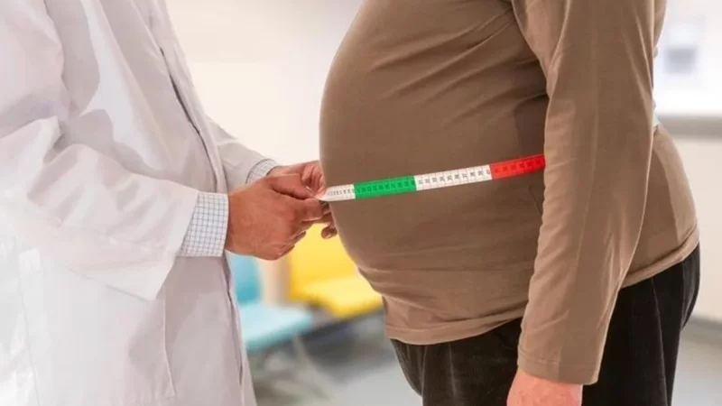 Dünya Sağlık Örgütü (DSÖ), obezitenin kronik ve yaşam boyu bakım