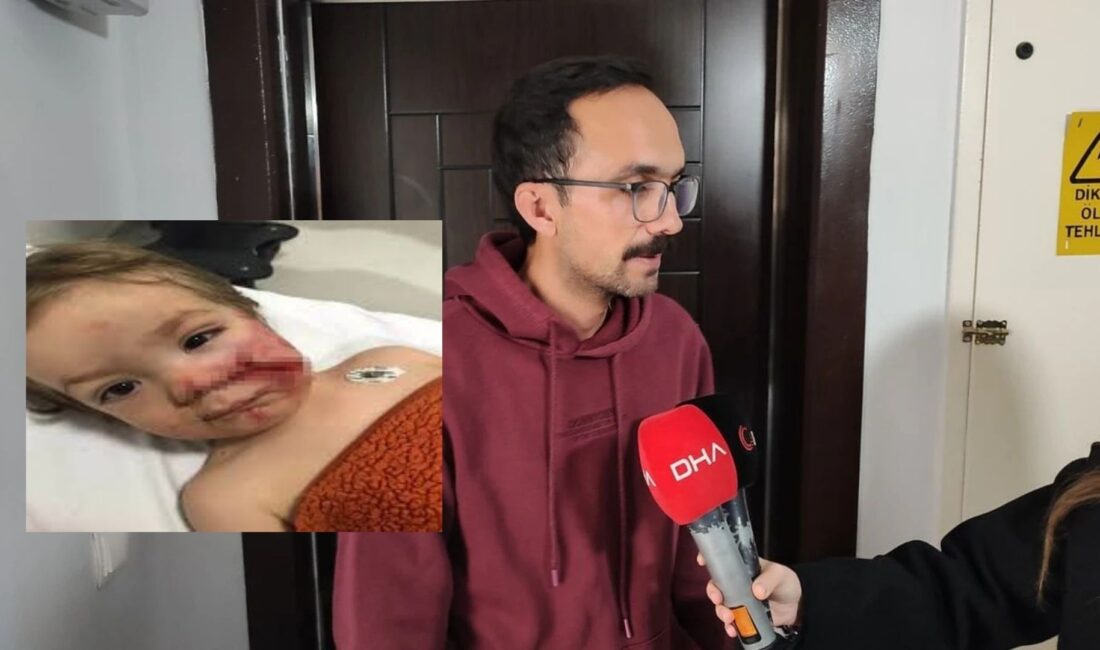 Ankara’nın Etimesgut ilçesinde iki küçük çocuğu pitbullun saldırısına uğrayan baba