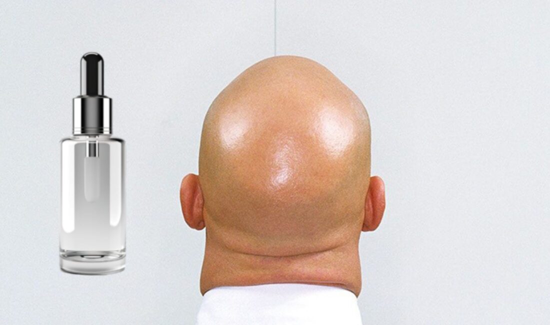 Milyonları sevindiren haber mi geldi? Bilim insanları kelliğe çare buldu.