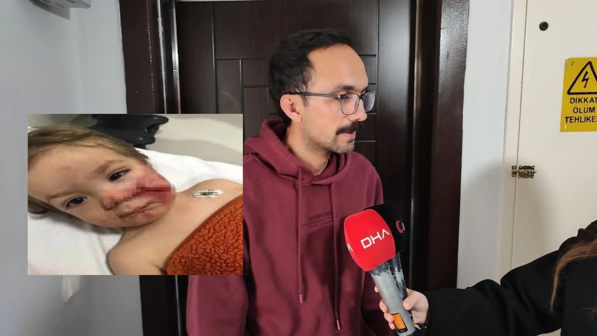 Ankara’nın Etimesgut ilçesinde iki küçük çocuğu pitbullun saldırısına uğrayan baba