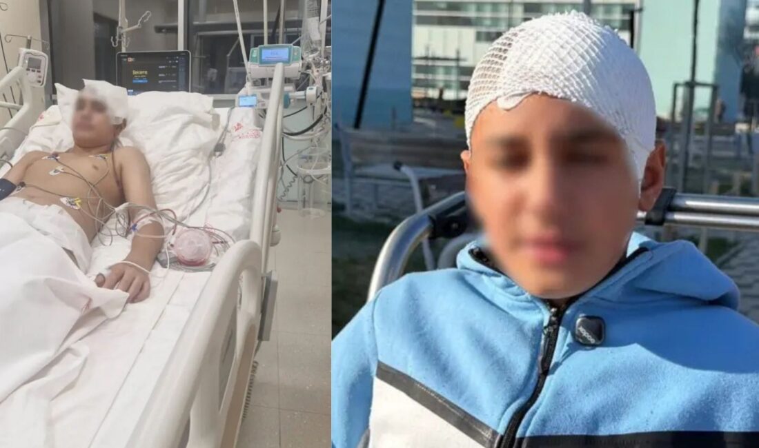 Akran zorbalığı sınırlarını aştı, arkadaşıyla tartışan çocuk eline aldığı taşla