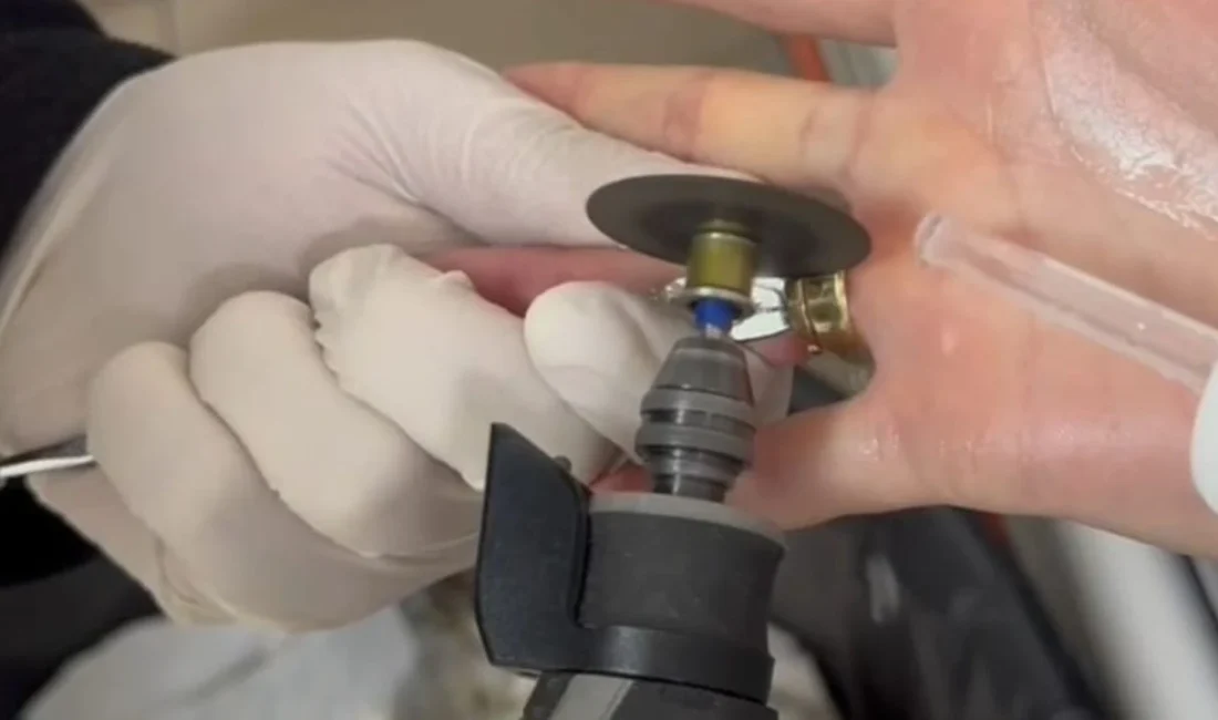 Batman'da parmağına sıkışan iki yüzüğü kendi başına çıkaramayan kadın, hastane