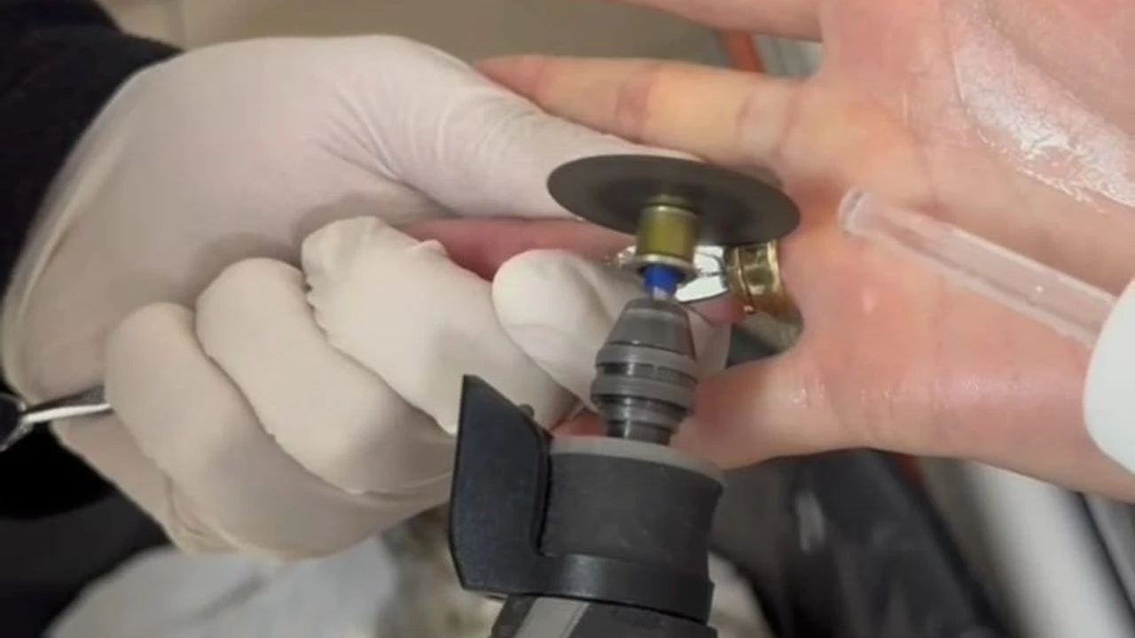 Batman'da parmağına sıkışan iki yüzüğü kendi başına çıkaramayan kadın, hastane