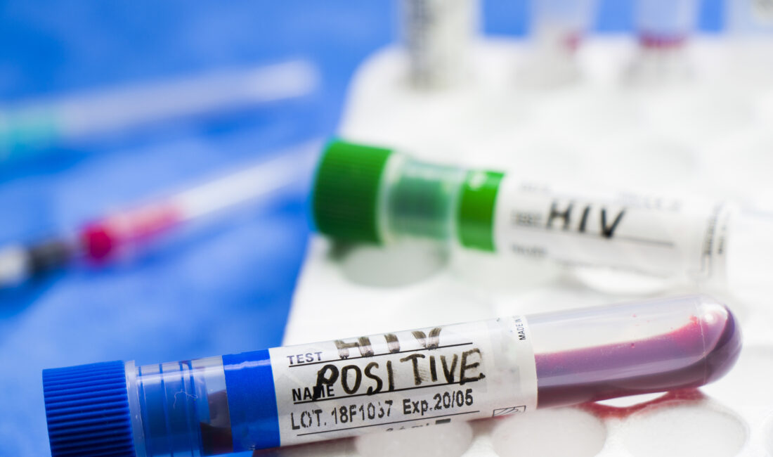 Etlik Şehir Hastanesi uzmanı Doç. Dr. Gönül Çiçek Şentürk, Türkiye’de