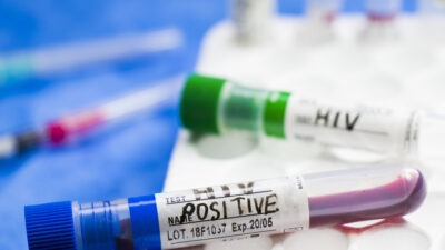 Etlik Şehir Hastanesi uzmanı Doç. Dr. Gönül Çiçek Şentürk, Türkiye’de