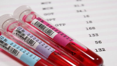 Bilim dünyasında taşları yerinden oynatan olay Brezilya'da yaşandı. Düşük yaptıktan