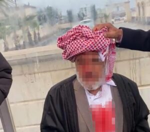 Şanlıurfa'nın Viranşehir ilçesinde, husumetlileri tarafından saldırıya uğrayan yaşlı adam ağır