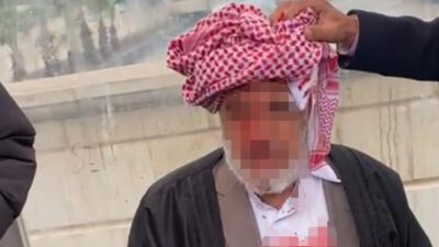 Şanlıurfa'nın Viranşehir ilçesinde, husumetlileri tarafından saldırıya uğrayan yaşlı adam ağır