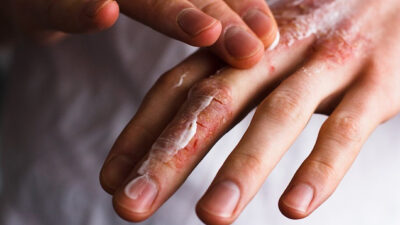 Havaların dondurucu seviyelere ulaştığı 2026 kışında, uzmanlardan hayati bir uyarı