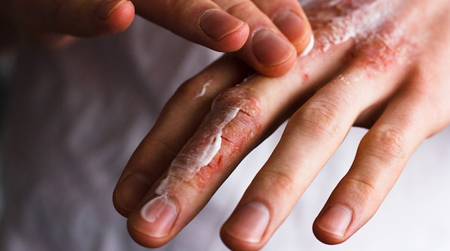 Havaların dondurucu seviyelere ulaştığı 2026 kışında, uzmanlardan hayati bir uyarı