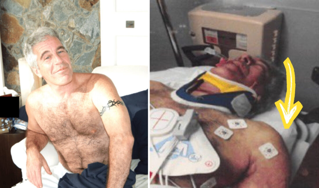 Jeffrey Epstein vakası, ölümüyle ilgili çelişkiler ve otopsi fotoğraflarındaki detaylar