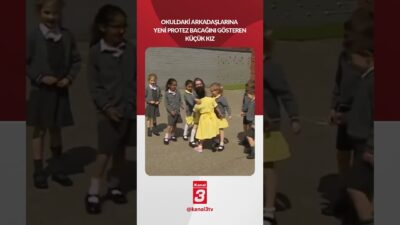 Okuldaki arkadaşlarına yeni protez bacağını gösteren küçük kız ve arkadaşlarının