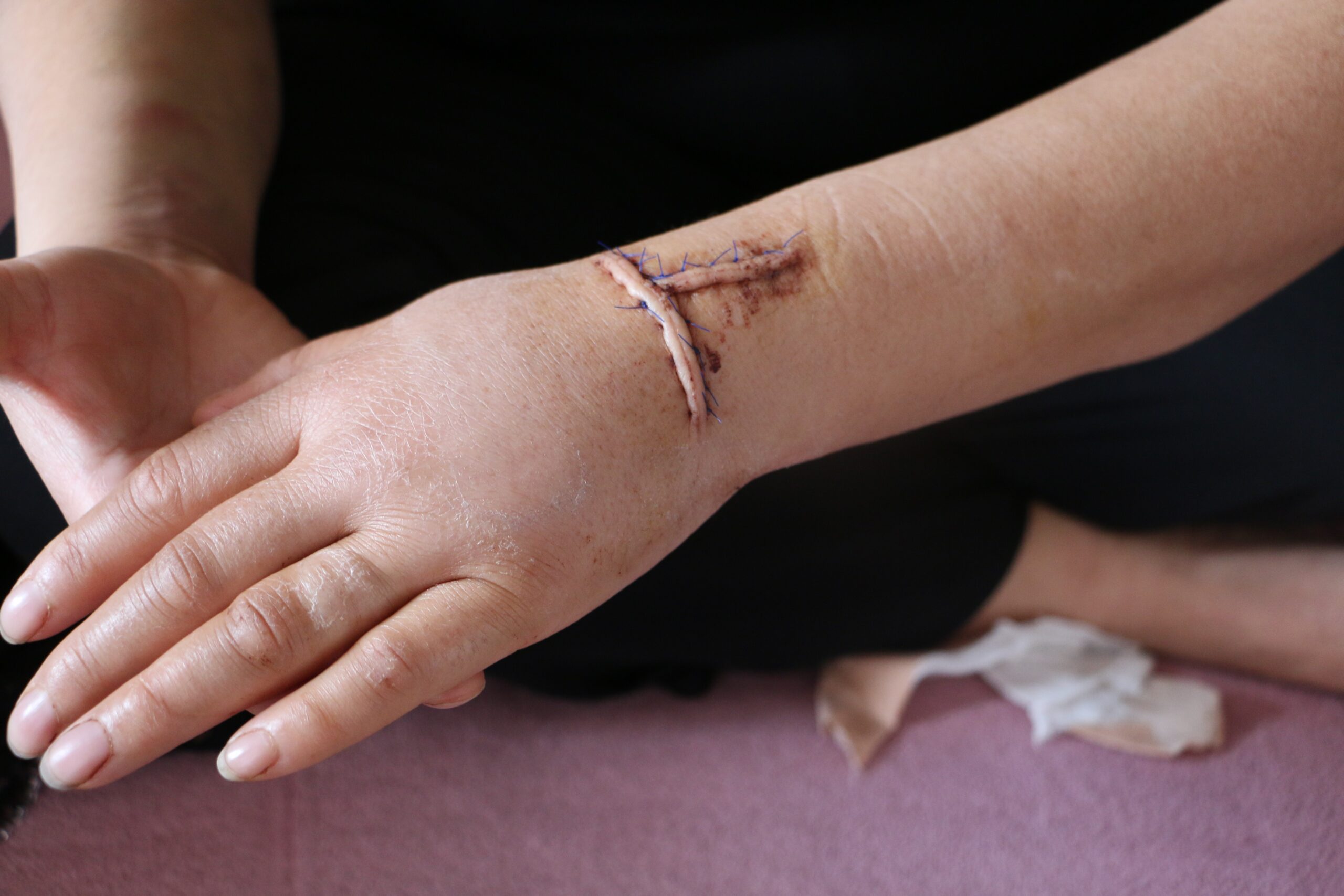 Diyarbakır, kan donduran bir kadına şiddet olayıyla sarsıldı. 16 yıllık