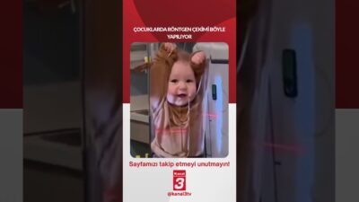 Çocuklarda röntgen çekimi böyle yapılıyor… 📶https://kanal3.com.tr/ Sosyal Medya Hesaplarımızı Takip