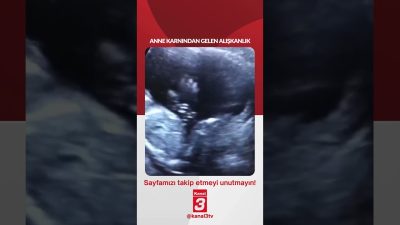 Anne karnından gelen alışkanlık… 📶https://kanal3.com.tr/ Sosyal Medya Hesaplarımızı Takip Ederek