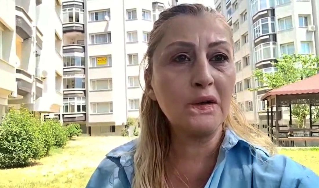Antalya'da estetik işlem sonrası dudağında doku kaybı yaşadığını ileri süren