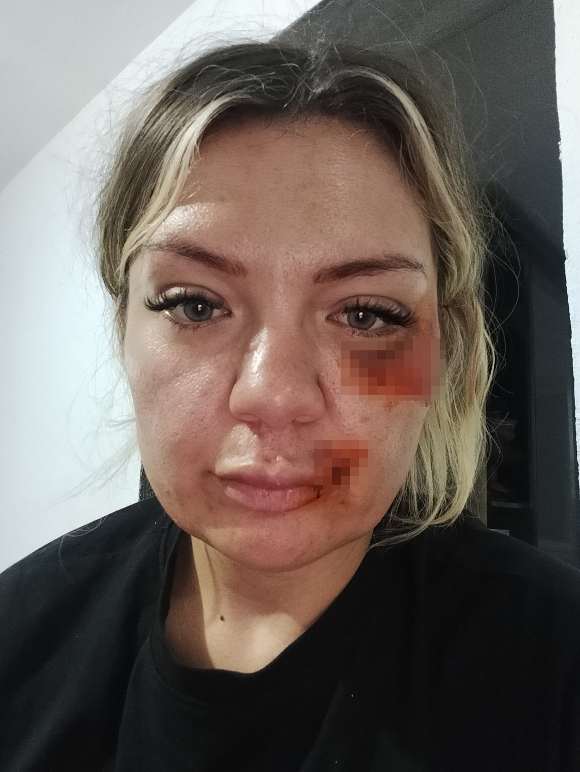 "Bıçak kırılmasaydı yaşama şansım yoktu" 2 "Bıçak kırılmasaydı yaşama şansım yoktu"
