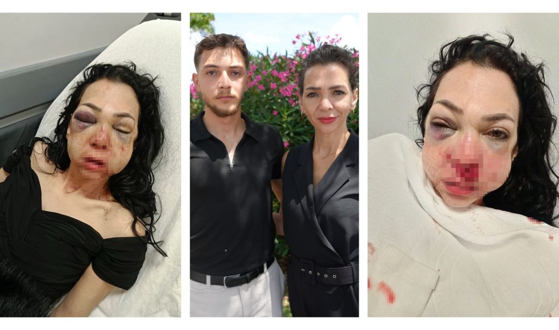 Kocaeli'nin İzmit ilçesinde kafede uyardıkları grubun saldırısına uğrayarak ağır yaralanan