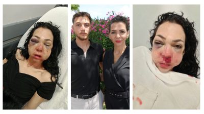 Kocaeli'nin İzmit ilçesinde kafede uyardıkları grubun saldırısına uğrayarak ağır yaralanan