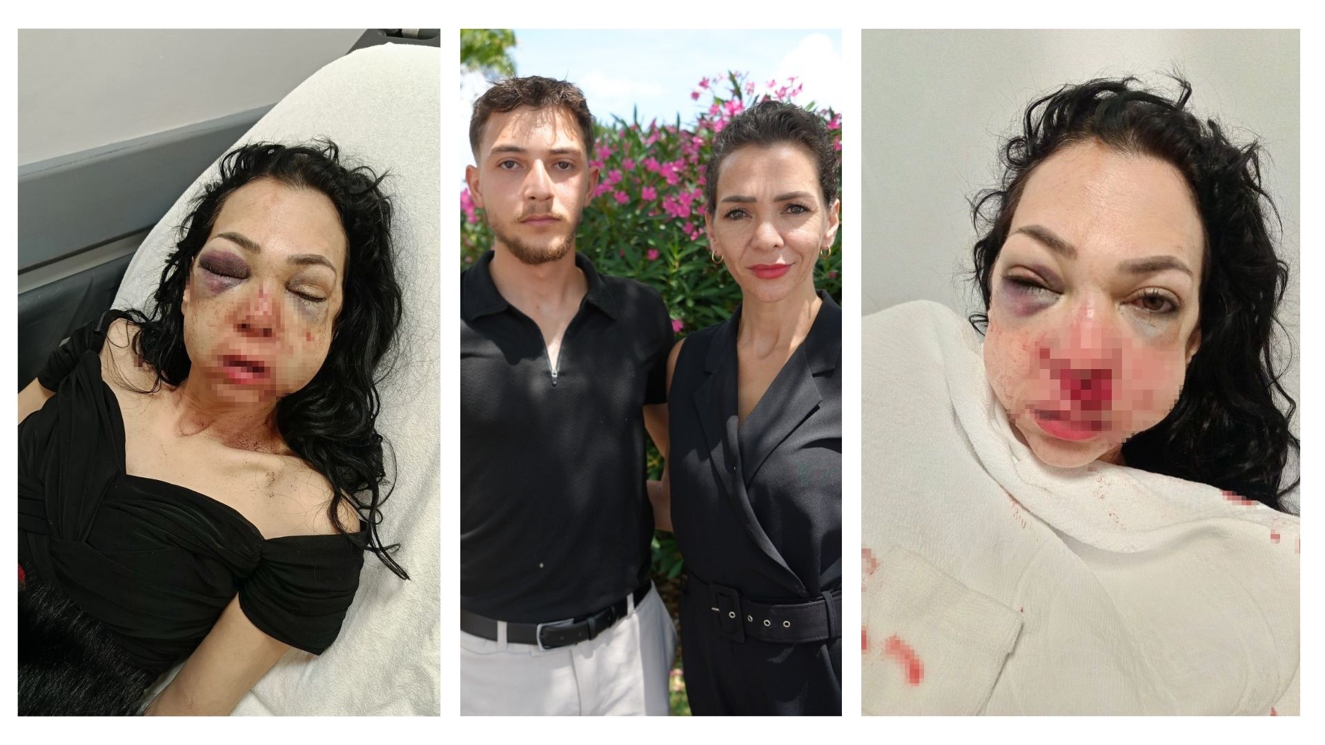 Kocaeli'nin İzmit ilçesinde kafede uyardıkları grubun saldırısına uğrayarak ağır yaralanan