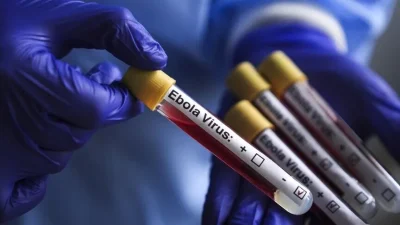 ABD, Kongo Demokratik Cumhuriyeti'nde (KDC) görülen Ebola salgını nedeniyle, son
