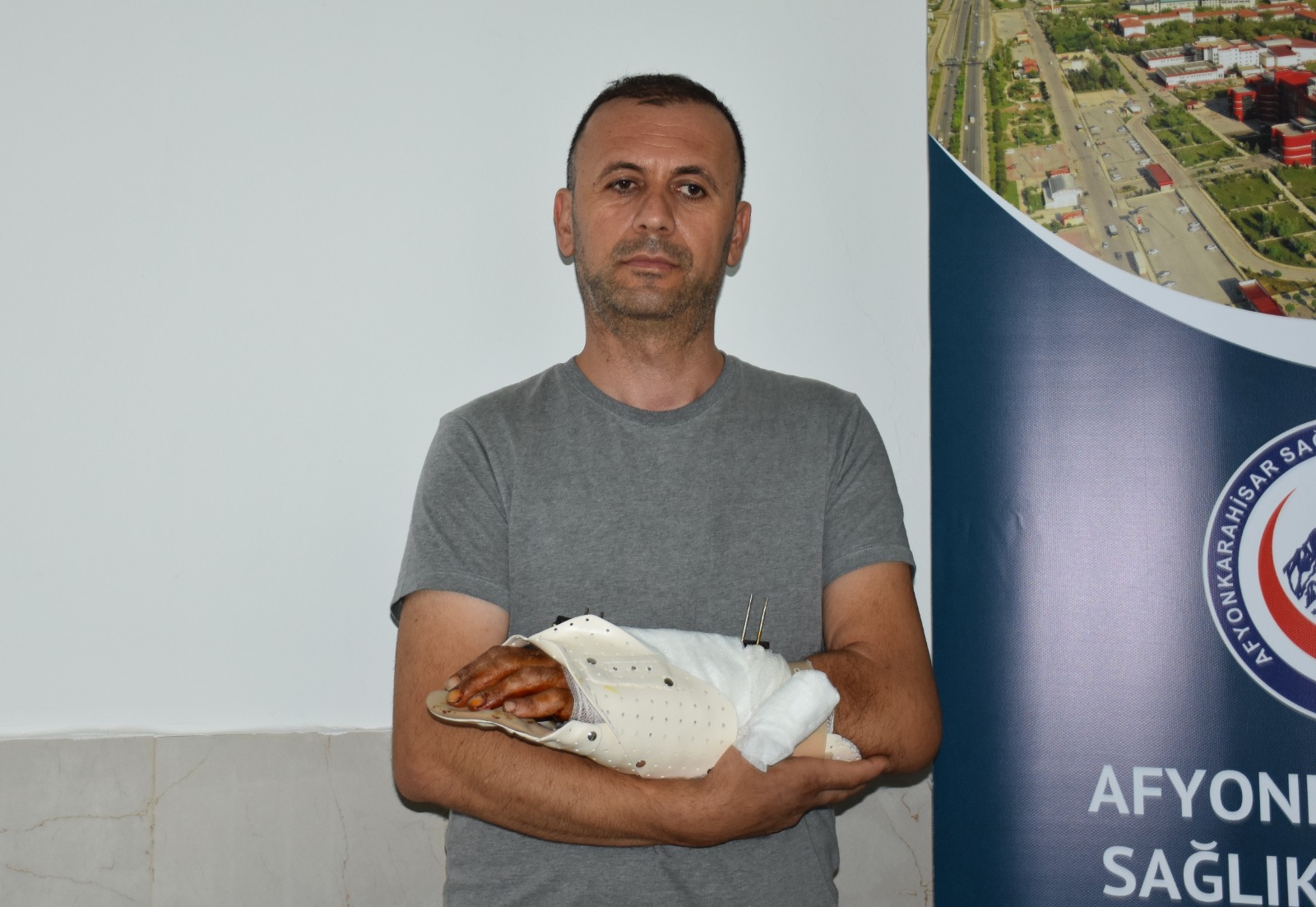 Bileği kopma noktasındaydı, 12 saatlik operasyonla kurtarıldı 1 Bileği kopma noktasındaydı, 12 saatlik operasyonla kurtarıldı