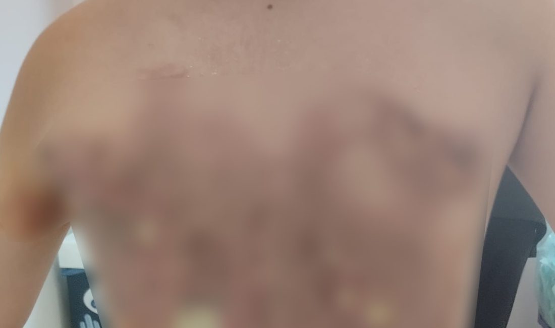 İstanbul Arnavutköy'de iddiaya göre 12 yaşındaki çocuk akran zorbalığına uğradı.