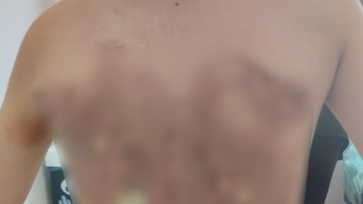 İstanbul Arnavutköy'de iddiaya göre 12 yaşındaki çocuk akran zorbalığına uğradı.