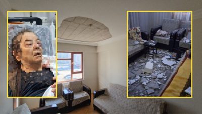 Kayseri’nin Melikgazi ilçesinde tavanın çökmesi sonucu bir gözünü kaybeden yaşlı